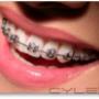 Subido por visitante en 09-01-2016 - Sonrisa