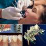 Estética e Implantes