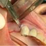 CIRUGIA PERIODONTAL