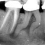 ENDODONCIAS