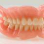 Prótesis Dental Total