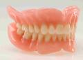 Prótesis dental Removible Total