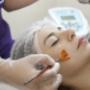 tratamiento de Peeling