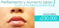 Relleno de Labios