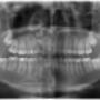 Radiografia