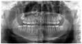 radiografía dental
