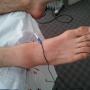 Esguince de tobillo