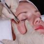 peeling facial