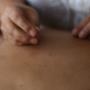 Acupuntura