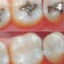 Texto institucional (700 caracteres): 
En Dentiestetika tenemos un lugar acondicionado para entregarte un servicio higiénico y cercano, en donde podrás sentirte cómodo y seguro.

Ven a conocer nuestras instalaciones agendando tu evaluación sin costo