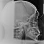 Radiologia 5