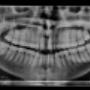 rRadiologia 4