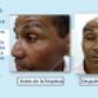 Limpieza Facial