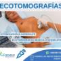 Ecotomografías