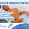 Ecotomografias
