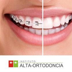 Clínica Dental Alta Ortodoncia